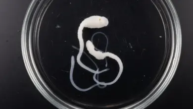 A Microscope Image Of A Tapeworm Cestoda Class Of The Notorious Tapeworm